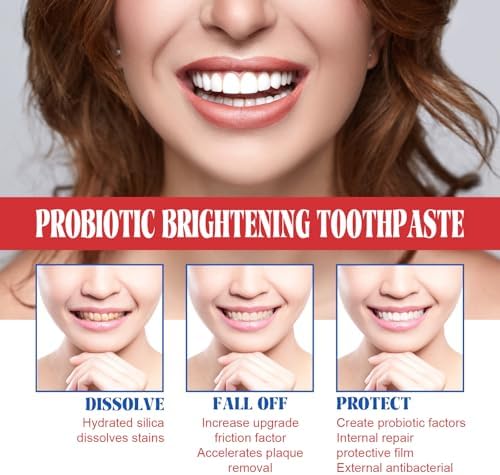 SP-6 Probiotics Whitening Toothpaste, Ultra Whitening Toothpaste – Enamel Safe Formula for Sensitive Teeth, Mint Freshness, Fresh Breath, 100g (4.23 Ounce, Mint)