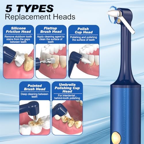 Tooth Polisher, Tooth Whitening Kit for Teeth Cleaning and Whitening, Rechargeable Teeth Polisher for People/Pets,Teeth Cleaning Kit with 5 Brush Heads,4 Speed Modes and LED Light, Waterproof(Blue)
