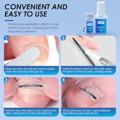 Titanium Alloy Ingrown Toenail Treatment, Ingrown Toenail Corrector Kit Specially Designed for Curved Nail Repair with Clip & Pusher & Protector Tool