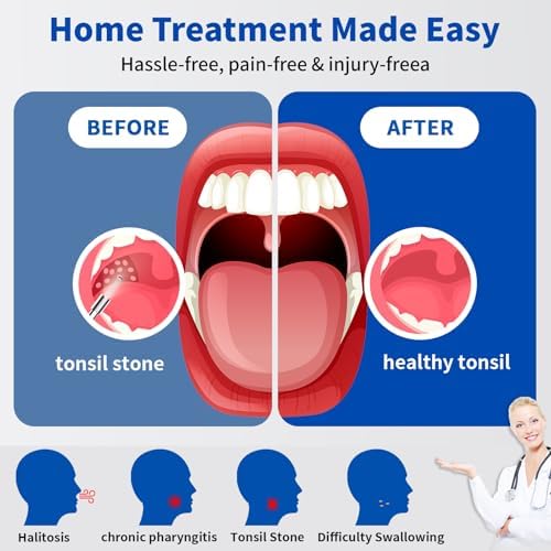 Tonsil Stone Remover with Camera，Tonsil Stone Removal Tool with LED Light，TonsilCleaner for Tonsil Stone Removal，Tonsillolith Removal Tool with 4 Head ，Attachments for iOS & Android (Black and Gold)
