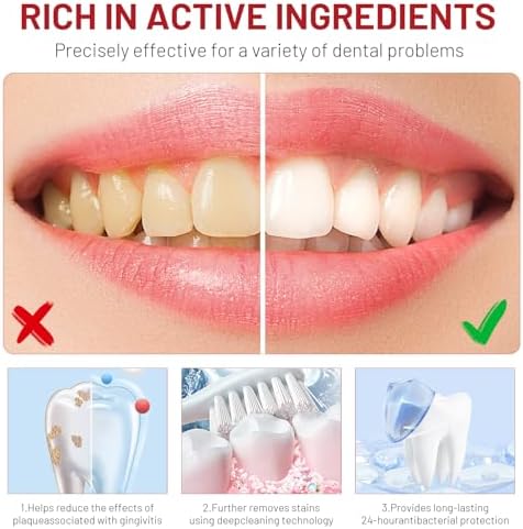 Sp10 Probiotic Toothpaste, Sp-10 Ultra Whitening Toothpaste, Fresh Breath Stain Removal, Deep Cleaning Care(2pcs)
