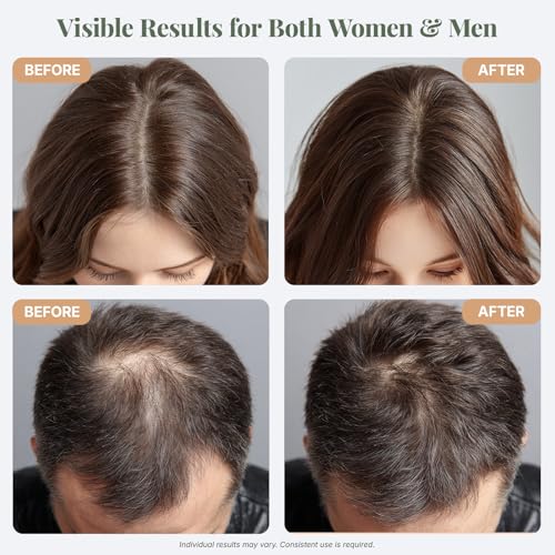 The ÉLIX USDA Organic Rosemary Oil for Hair Growth | Thickening Formula with Castor & Pumpkin Seed | for Hair Loss & Thinning | Made in USA | 4oz