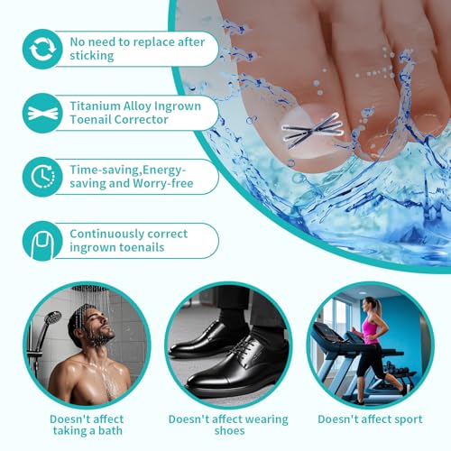 Upgraded Titanium Alloy Ingrown Toenail Corrector with Upgraded 6-Angle Shape,3x Stronger Pull Force,Ingrown Toenail Removal Kit, Ingrown Toenail Treatment for Women and Man (Large Size-6 Packs)