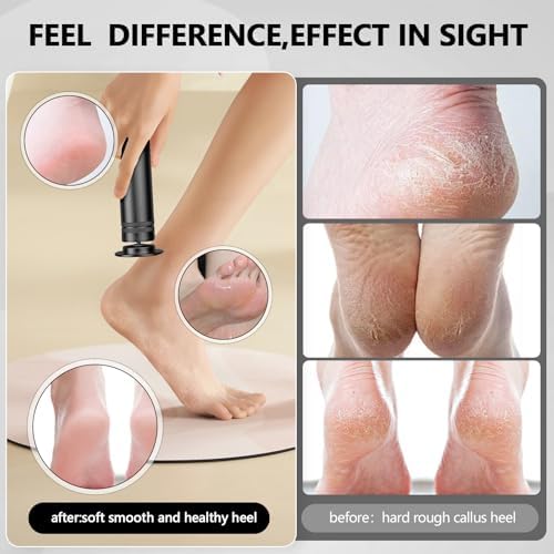 Professional Electric Foot Callus Remover 1200 RPM Adjustable Speed Metal Foot Grinder for Dead Skin Automatic Heel Sander with Replacement Sandpaper Discs for Women Men Feet Pedicure Tools (Black)
