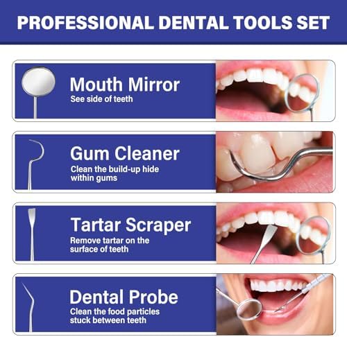 Tooth Repair Kit, Safe and Comfortable Replacements, Moldable Tooth Filling Repair Kit, Make You Smile Confidently Again (30mL)