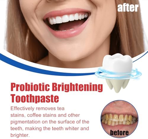 SP-6 Probiotics Whitening Toothpaste, Ultra Whitening Toothpaste – Enamel Safe Formula for Sensitive Teeth, Mint Freshness, Fresh Breath, 100g (4.23 Ounce, Mint)