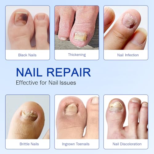 Nail Patches 42 PCS Toenail Treatment Extra Strength 8-Hour Overnight Nail Fast Acting Repair Effortless Hydrogel Nail Care and Repair for Damaged Nails Overnight Renewal for Men and Women