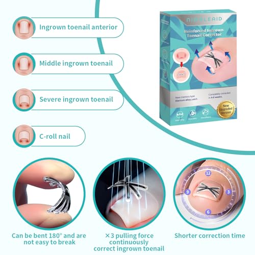 Upgraded Titanium Alloy Ingrown Toenail Corrector with Upgraded 6-Angle Shape,3x Stronger Pull Force,Ingrown Toenail Removal Kit, Ingrown Toenail Treatment for Women and Man (Large Size-6 Packs)