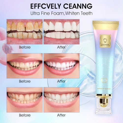 Niacinamide Whitening Toothpaste,Niacinamide Intensive Whitening Toothpaste, Niacinamid Toothpast,Niacinamide White Toothpastes,Complete Care Toothpastes,Remove Tooth Stains （2 PCS）
