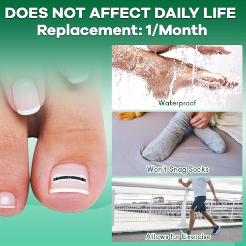 Titanium Alloy Ingrown Toenail Corrector New Version Ingrown Toenail Removal Tool Kit, Designed for Curved Nail Repair Big Toe Ingrown Toenail