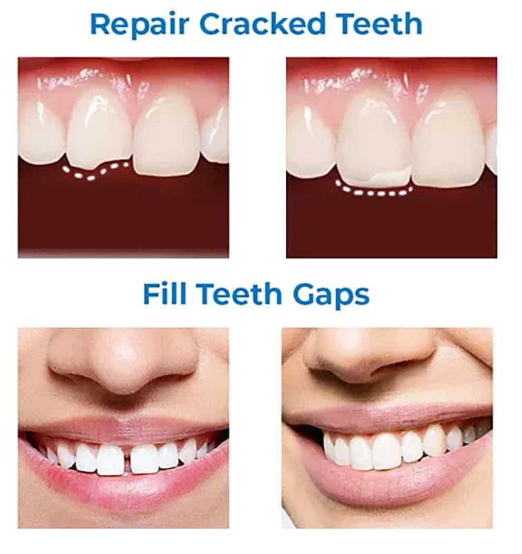 Tooth Repair Kit, Moldable Tooth Filling Repair Kit Beads with 3 Dental Tool, Moldable False Teeth Beads The Missing and Broken Replacements, DIY Natural Filling Fake Teeth,Smile Confidently Again
