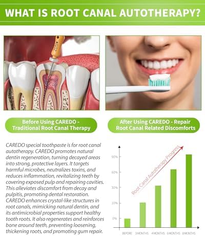 Toothpaste Gum Repair for Avoid Root Canal Therapy, Gingivitis Treatment for Pulpitis Discomforts and Tooth Repair, Remineralizing Hydroxyapatite Toothpaste for Root Canal Discomforts, Mint 3.52 OZ