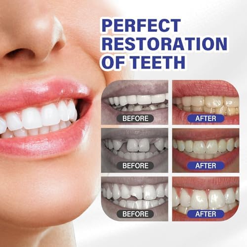 Tooth Repair Kit, Safe and Comfortable Replacements, Moldable Tooth Filling Repair Kit, Make You Smile Confidently Again (30mL)