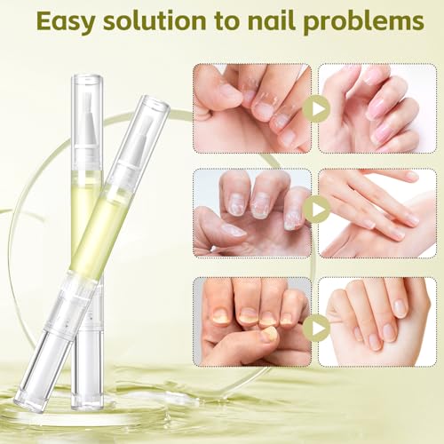Nailz Nail 𝐆𝐫𝐨𝐰𝐭𝐡 Pen,Radiant Nail Growth GIL,Radiant Nail Growth Oil Pen,Cuticle Oil for Nails,Nail Strengthener, for Moisturize Strengthen Nail Care,Finger Edge Manicure Nourishing Pen(4PCS)