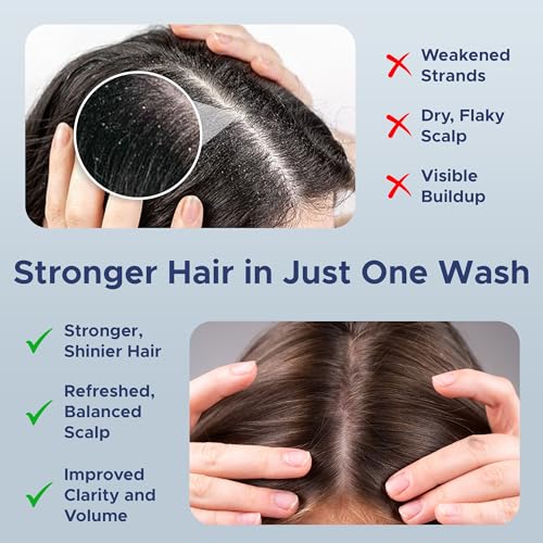 Nora Ross Classic Garlic Shampoo – Thickening and Hair Growth Shampoo for Men and Women with Normal to Dry, Thinning Hair – All Natural Anti-Dandruff and Scalp Cleanser Formula with Rosemary – 32oz