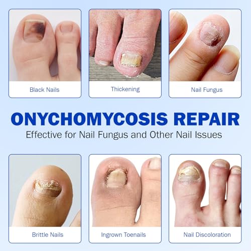 Toenail Fungus Treatment Extra Strength Nighttime Renewal Fungal Nail Patches - 21 Patch - Overnight Repair for Nail Fungus Damage, 8-Hour Treatment Restores Healthy Appearance (21 Count (Pack of 3))