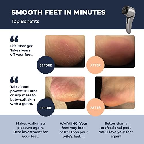 Electric Foot Callus Remover with Vacuum - Own Harmony Professional Pedicure Tools Kit for Powerful Pedi Feet Care Vac, Electronic Foot File CR2100, Best for Hard, Dry, Cracked, Dead Skin (3 Rollers)